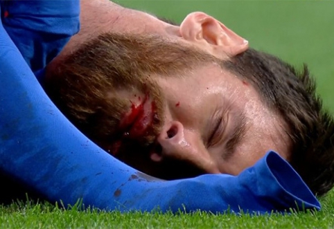 Real fighter: L. Messi did not stop and lost teeth (PHOTO, VIDEO)