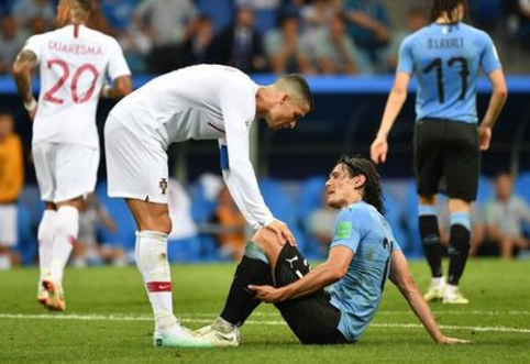 Uruguay will Fight against the French without E. Cavani