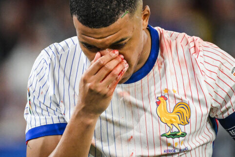 K. Mbappe with a broken nose will miss the match against the Dutch