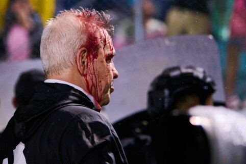 After the fans' assault – the bloody coach of the Mexican national team