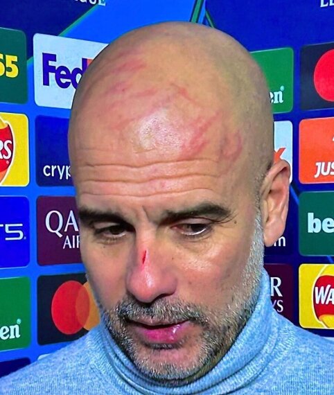 After yet another disappointing defeat, P. Guardiola appeared battered at the press conference.