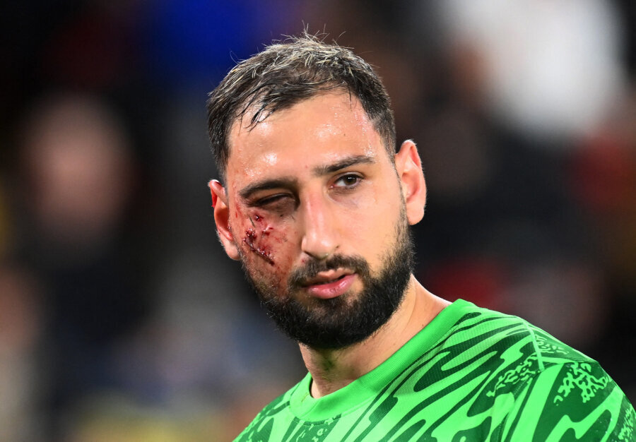 G. Donnarumma suffered a horrific injury